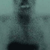 }16