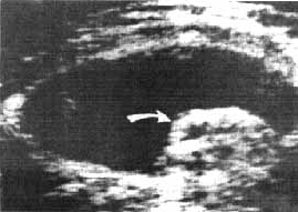 図33