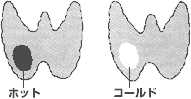 図5.2