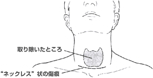 図6.1