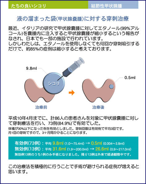 hz